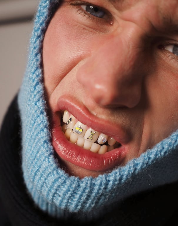 SKI