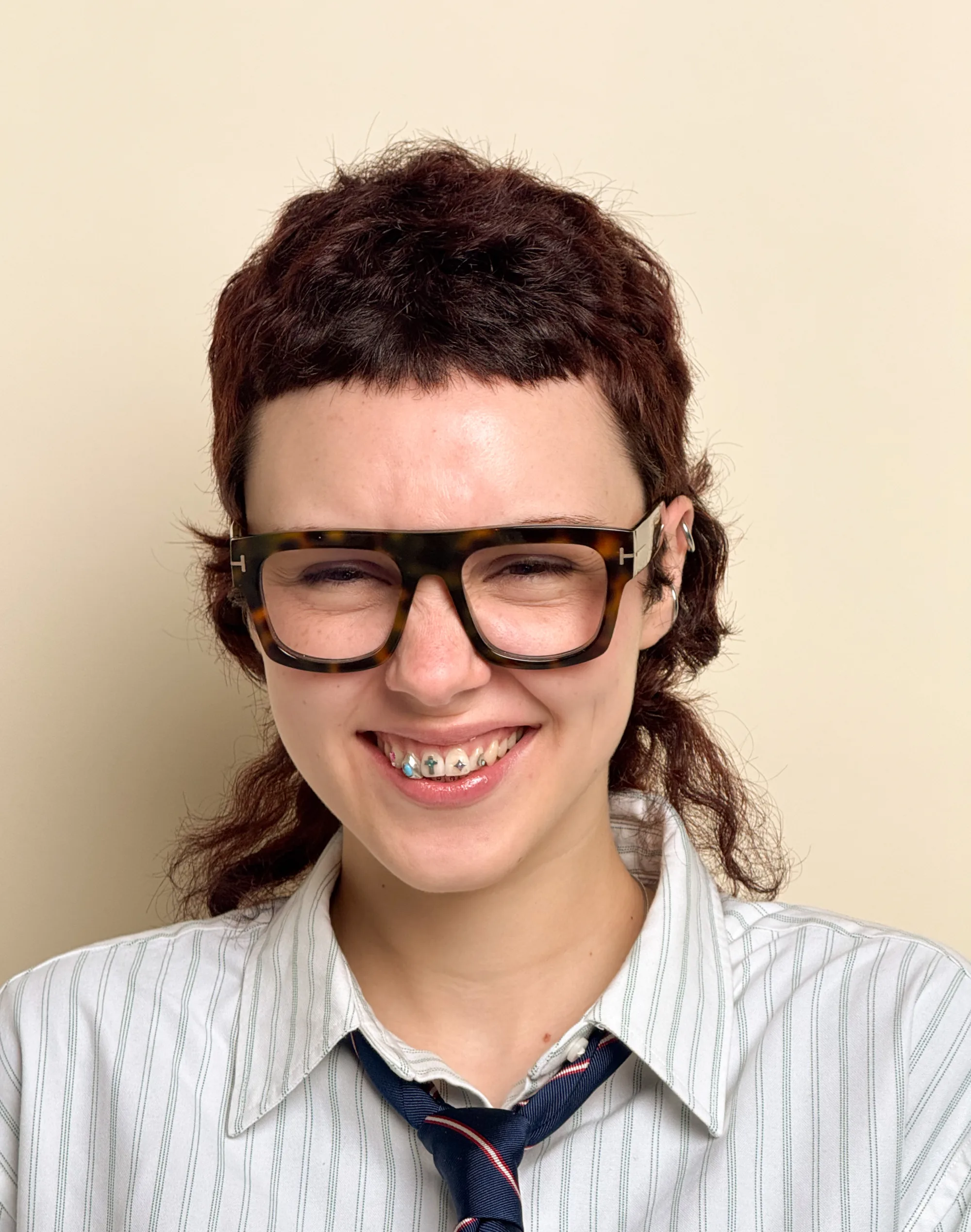 Colocación y revisión dental incluida en todos nuestros precios